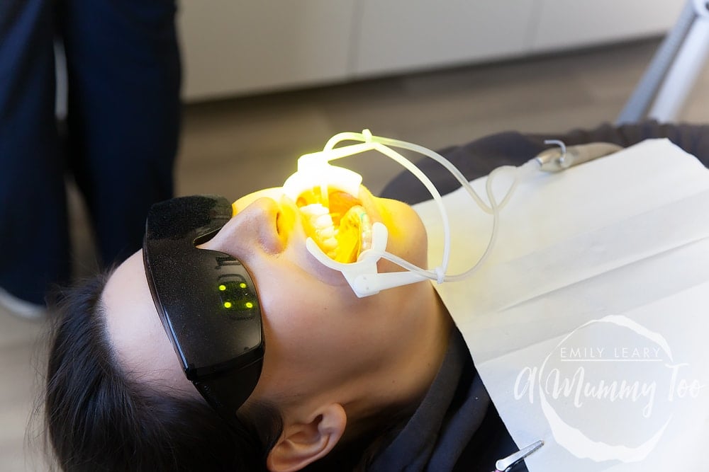 a young woman laid on a dentist chair wearing sunglasses with mouth guards in to keep her mouth open.